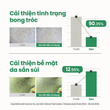 Gel Tẩy Tế Bào Chết Axis-Y PHA Dịu Nhẹ (PHA Resurfacing Glow Peel) 50ml
