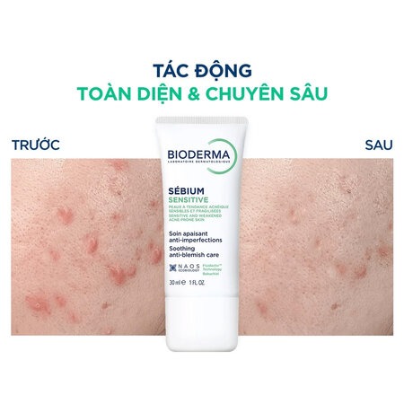 Kem Dưỡng Ẩm Bioderma Dành Cho Da Mụn, Nhạy Cảm 30ml