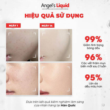 Serum Angel's Liquid Làm Sáng, Kiểm Soát Dầu (Glutathione + Niacinamide Cica Ampoule)